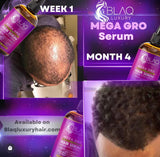 BLAQ LUXURY Mega Gro Hair Serum 4oz